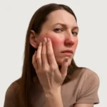 Woman with dry and irritated facial skin touching her cheek in discomfort
